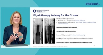 Transformation der prothetischen Versorgung: Einblicke vom Genium X4 Symposium